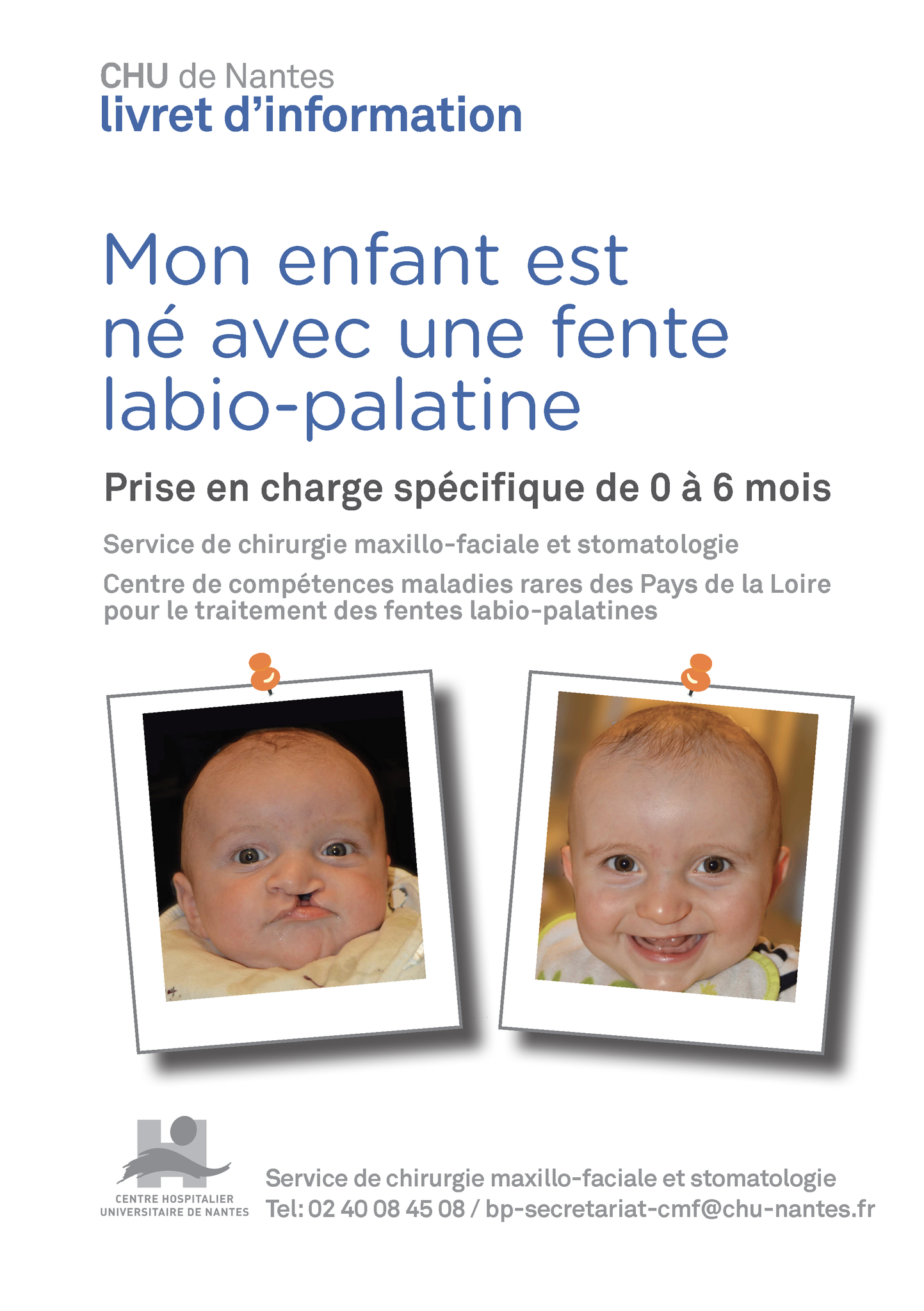 CCMR MAFACE CHU Nantes Livret d'information FLP 0 6mois