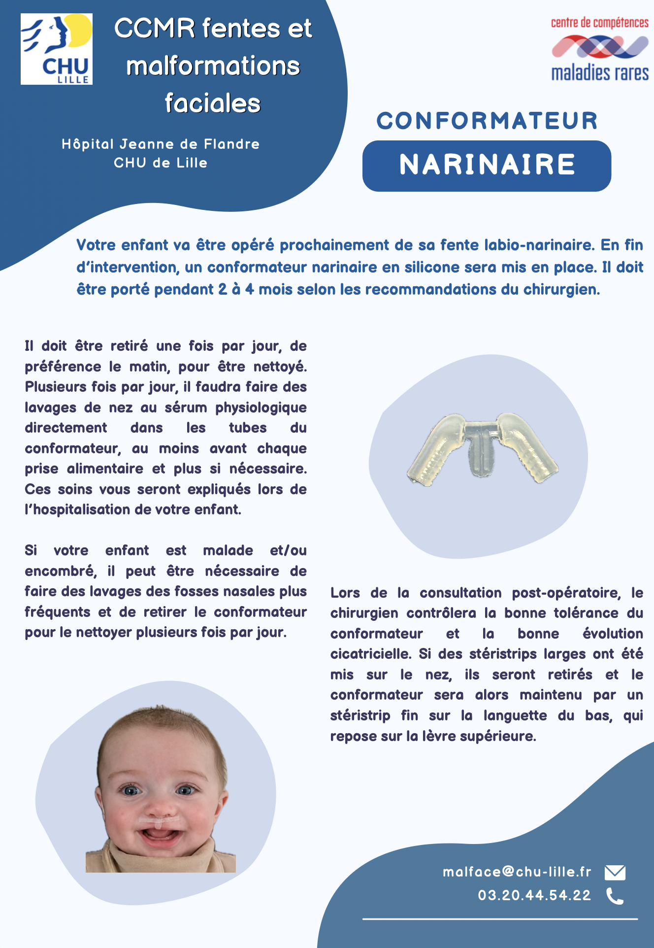 Image fiche conformateur narinaire CCMR Lille