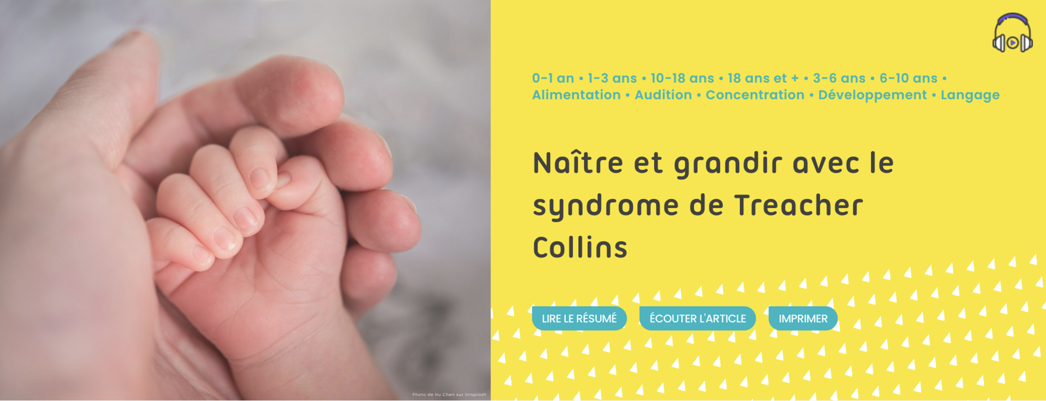 Image site Allo Ortho Page Naitre avec Treacher Collins