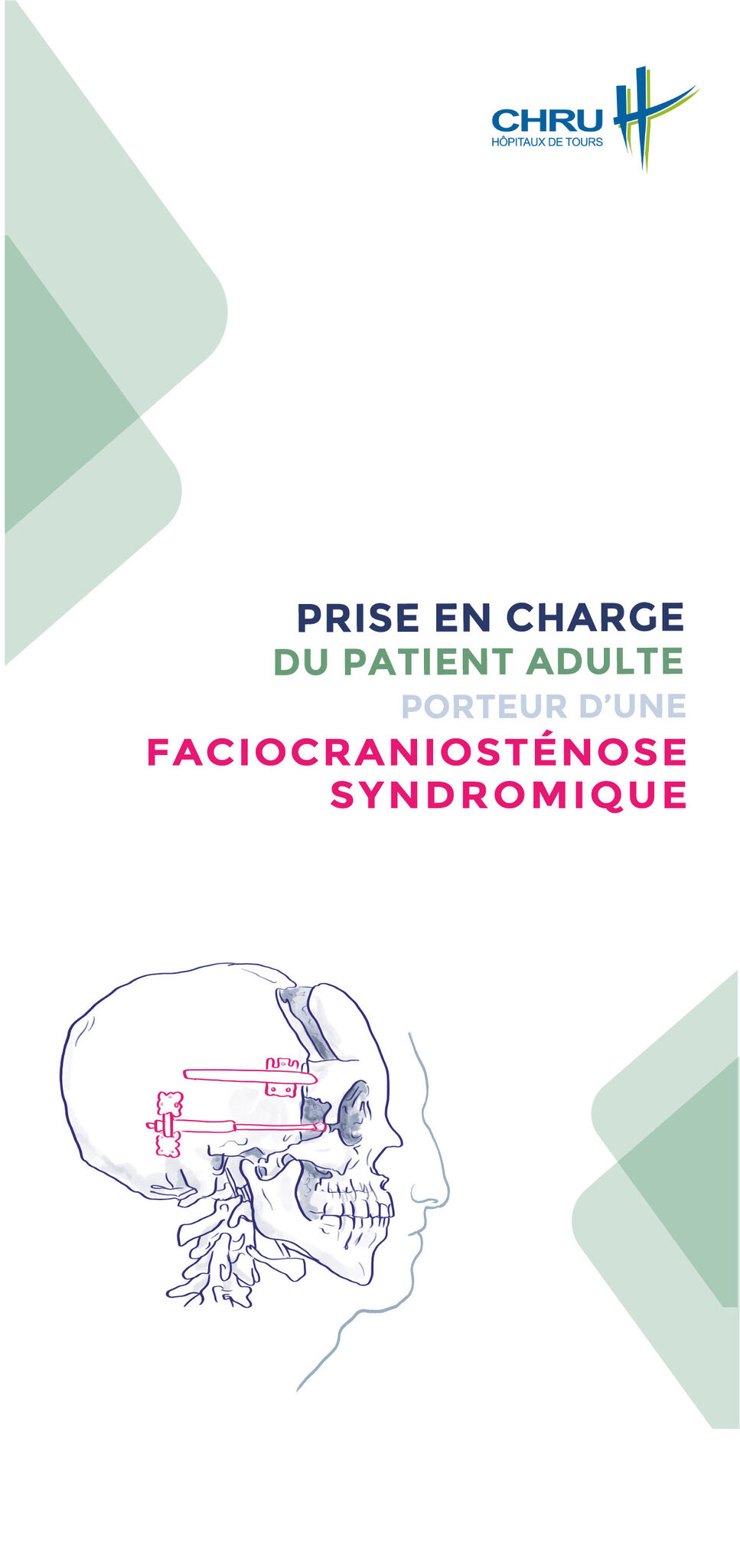 Maquette #craniostenose p1