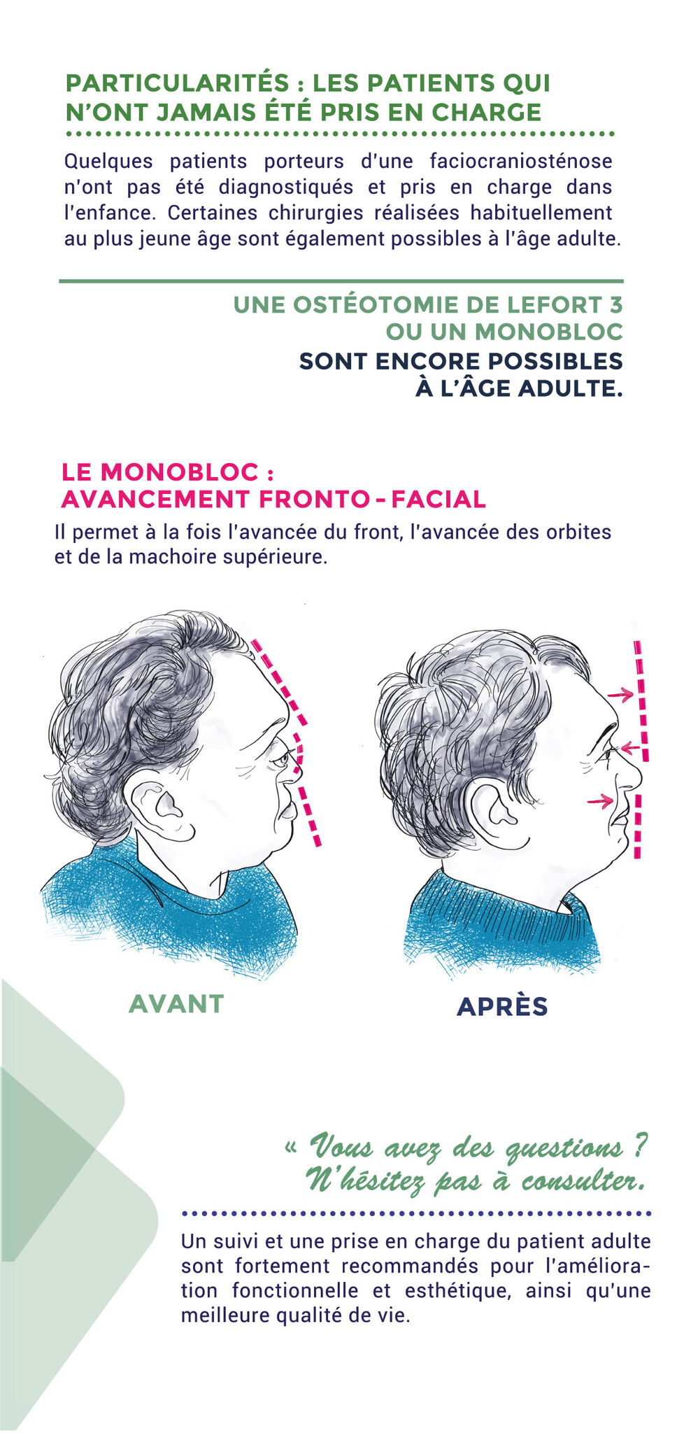 Maquette #craniostenose p5