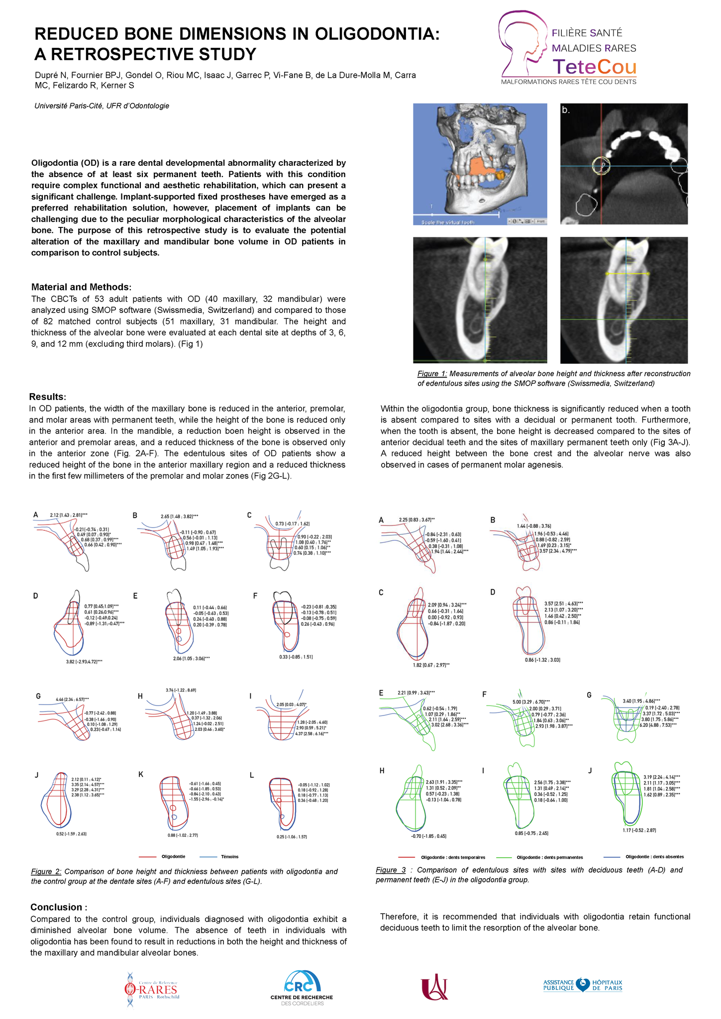 Poster Dupré