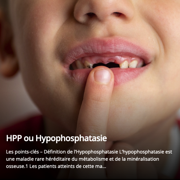 Rare à l'écoute Hypophosphatasie