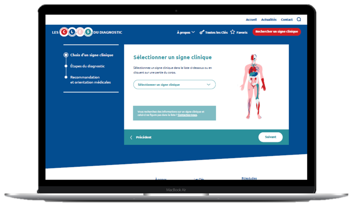 Recherche signe clinique Site Cles du diagnostic FSMR